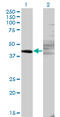 Zinc Finger And SCAN Domain Containing 9 antibody, LS-C198492, Lifespan Biosciences, Western Blot image 