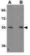 Karyopherin Subunit Alpha 4 antibody, GTX31813, GeneTex, Western Blot image 