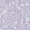 Myosin Binding Protein C, Fast Type antibody, HPA042991, Atlas Antibodies, Immunohistochemistry paraffin image 