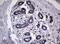 Ribonucleotide Reductase Catalytic Subunit M1 antibody, NBP2-45964, Novus Biologicals, Immunohistochemistry paraffin image 
