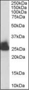Triosephosphate Isomerase 1 antibody, orb88316, Biorbyt, Western Blot image 