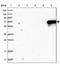 Myotilin antibody, NBP2-38361, Novus Biologicals, Western Blot image 