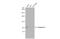 Tankyrase 2 antibody, GTX104638, GeneTex, Western Blot image 