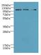 DIS3 Like Exosome 3'-5' Exoribonuclease antibody, LS-C378303, Lifespan Biosciences, Western Blot image 