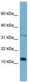 Pleckstrin Homology Like Domain Family A Member 2 antibody, TA344404, Origene, Western Blot image 