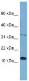 Pleckstrin Homology Like Domain Family A Member 2 antibody, TA344404, Origene, Western Blot image 