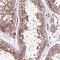 Spermatogenesis Associated Serine Rich 2 antibody, PA5-58477, Invitrogen Antibodies, Immunohistochemistry paraffin image 