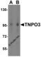 Transportin 3 antibody, 4599, ProSci Inc, Western Blot image 
