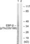 CCAAT Enhancer Binding Protein Beta antibody, LS-C198706, Lifespan Biosciences, Western Blot image 