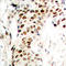 Ras Responsive Element Binding Protein 1 antibody, LS-C368501, Lifespan Biosciences, Immunohistochemistry frozen image 