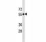C-C Motif Chemokine Receptor 7 antibody, F53696-0.1ML, NSJ Bioreagents, Western Blot image 