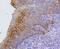 Keratin 17 antibody, NBP2-67318, Novus Biologicals, Immunohistochemistry paraffin image 