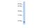 Transmembrane Protein 35A antibody, A17110, Boster Biological Technology, Western Blot image 