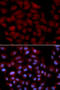 ACK1 antibody, STJ25905, St John