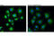 Stromal Interaction Molecule 1 antibody, 5668S, Cell Signaling Technology, Immunofluorescence image 