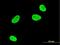 Serum/Glucocorticoid Regulated Kinase 1 antibody, H00006446-M04, Novus Biologicals, Immunofluorescence image 