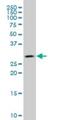 Carbonic Anhydrase 1 antibody, H00000759-M07, Novus Biologicals, Western Blot image 