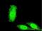Interleukin 1 Receptor Associated Kinase 3 antibody, H00011213-M06, Novus Biologicals, Immunofluorescence image 