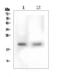 Eva-1 Homolog A, Regulator Of Programmed Cell Death antibody, A11580-1, Boster Biological Technology, Western Blot image 