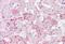 Alpha Fetoprotein antibody, MBS244768, MyBioSource, Immunohistochemistry paraffin image 