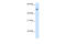 Argininosuccinate Lyase antibody, 29-615, ProSci, Enzyme Linked Immunosorbent Assay image 