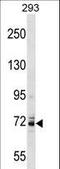 Potassium Voltage-Gated Channel Subfamily C Member 4 antibody, LS-C165415, Lifespan Biosciences, Western Blot image 