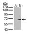 Synaptotagmin 1 antibody, PA5-27935, Invitrogen Antibodies, Western Blot image 