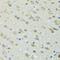 Dynactin Subunit 2 antibody, GTX55598, GeneTex, Immunohistochemistry paraffin image 