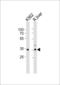 ATPase Na+/K+ Transporting Subunit Beta 2 antibody, LS-B9819, Lifespan Biosciences, Western Blot image 