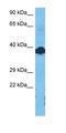 Ecdysoneless Cell Cycle Regulator antibody, orb324771, Biorbyt, Western Blot image 