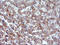 Vascular Endothelial Growth Factor B antibody, LS-C788503, Lifespan Biosciences, Immunohistochemistry paraffin image 