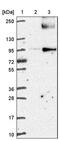 Phosphatidylinositol Glycan Anchor Biosynthesis Class N antibody, PA5-58987, Invitrogen Antibodies, Western Blot image 