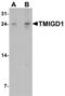 Transmembrane And Immunoglobulin Domain Containing 1 antibody, LS-C201169, Lifespan Biosciences, Western Blot image 