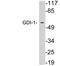 Rho GDP Dissociation Inhibitor Alpha antibody, LS-C199869, Lifespan Biosciences, Western Blot image 