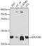 NADH:Ubiquinone Oxidoreductase Subunit AB1 antibody, A14657, ABclonal Technology, Western Blot image 