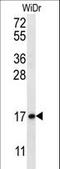 Tubulin-specific chaperone A antibody, LS-C161737, Lifespan Biosciences, Western Blot image 