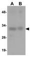 Transmembrane Protein 173 antibody, GTX85266, GeneTex, Western Blot image 