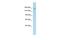 Lysine Demethylase 6A antibody, PA5-68598, Invitrogen Antibodies, Western Blot image 