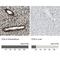 FUS RNA Binding Protein antibody, NBP1-89113, Novus Biologicals, Immunohistochemistry paraffin image 