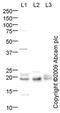 Cytochrome B-245 Alpha Chain antibody, ab75941, Abcam, Western Blot image 