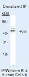 Actin Alpha 1, Skeletal Muscle antibody, MA5-11866, Invitrogen Antibodies, Immunoprecipitation image 