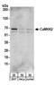 Calcium/Calmodulin Dependent Protein Kinase Kinase 2 antibody, A304-009A, Bethyl Labs, Western Blot image 