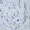 Cell Migration Inducing Hyaluronidase 1 antibody, 23-676, ProSci, Immunohistochemistry frozen image 