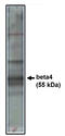 Calcium Voltage-Gated Channel Auxiliary Subunit Beta 4 antibody, AP05140PU-N, Origene, Western Blot image 