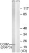 CFL1 antibody, LS-C117324, Lifespan Biosciences, Western Blot image 