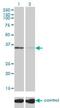 Tissue Specific Transplantation Antigen P35B antibody, H00007264-M01, Novus Biologicals, Western Blot image 