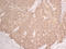 Keratin 5 antibody, LS-C744494, Lifespan Biosciences, Immunohistochemistry paraffin image 