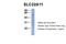 Solute Carrier Family 22 Member 11 antibody, ARP43994_P050, Aviva Systems Biology, Western Blot image 