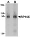 CD180 Molecule antibody, A05085-1, Boster Biological Technology, Western Blot image 