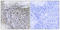 Zinc Finger MYND-Type Containing 11 antibody, LS-C119055, Lifespan Biosciences, Immunohistochemistry paraffin image 